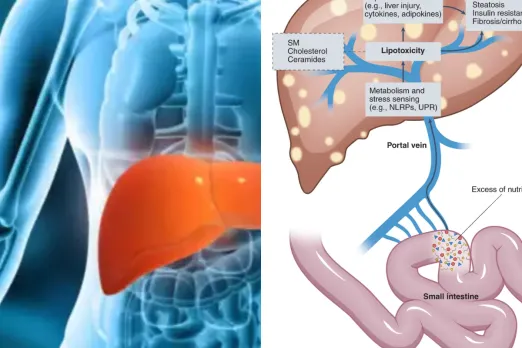 liver damage