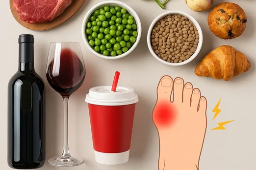 Uric Acid