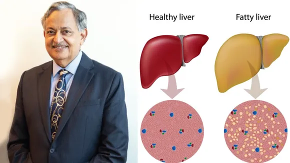 fatty liver result