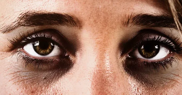 Dark Circles