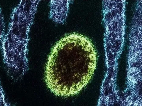 Zoonotic langya virus