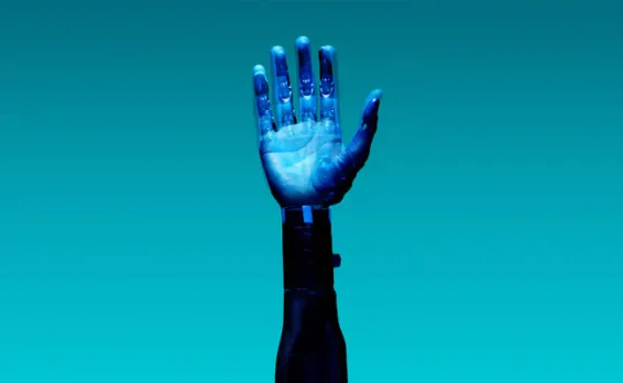 Prosthetic Hand