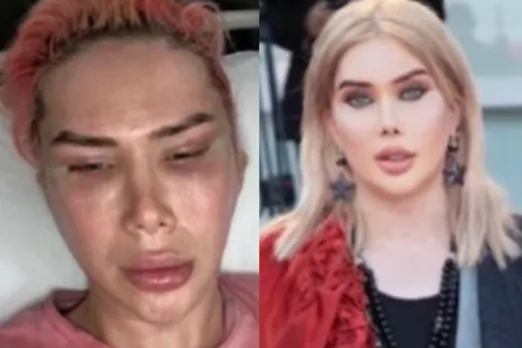 Cosmetic surgery