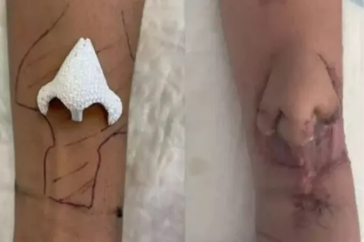 France woman nose