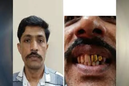 golden tooth implants