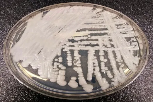 CDC