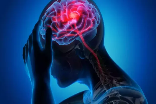 Brain Stroke