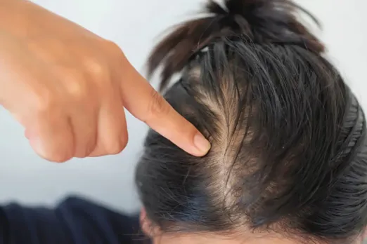 Hair Care Tips