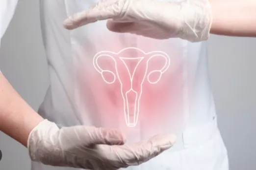 Cervical Cancer
