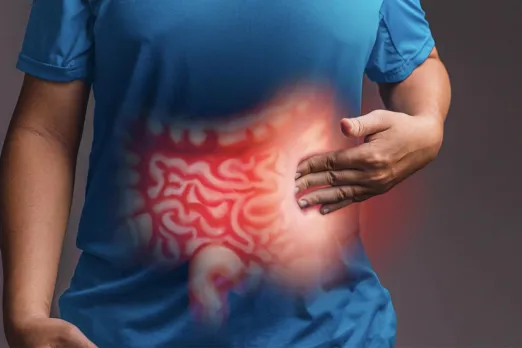 Inflammatory Bowel Disease