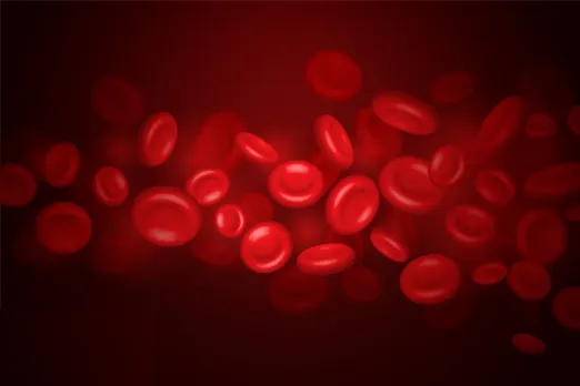 Sickle Cell Anemia