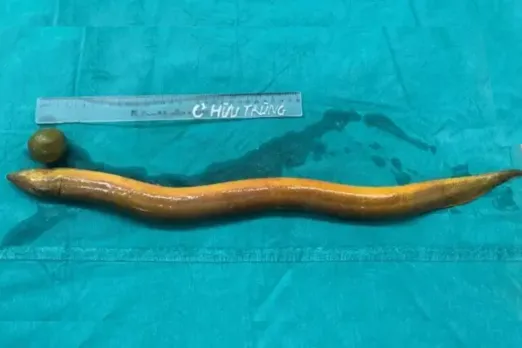 Live Eel