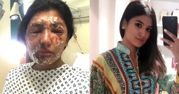 It's What's Beneath the Skin That Counts: Acid Attack Survivors Who Never Backed Down