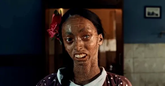 Abandoned Due to Rare Genetic Disorder, Nisha's Life Was Transformed By a Mother's Unconditional Love
