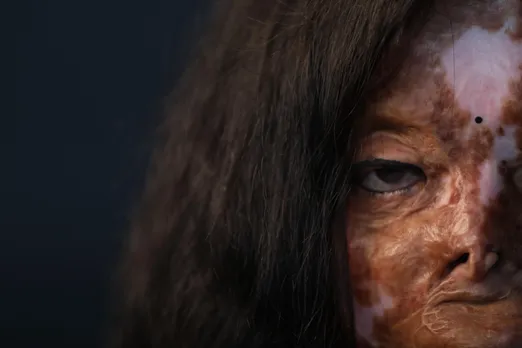 Video: Sheroes, Where Acid Couldn’t Destroy Their Dreams