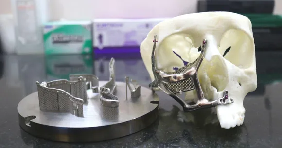 IIT-M Gives Free 3D-Printed Face Implants To Poor Patients Disfigured by Black Fungus