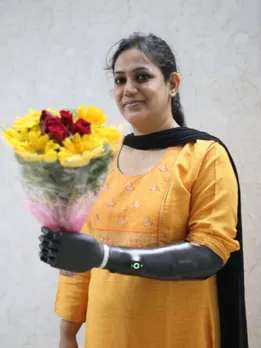 Hyd Startup Builds Low-Cost Bionic Arm, Calls It ‘KalArm’ After Dr APJ Abdul Kalam