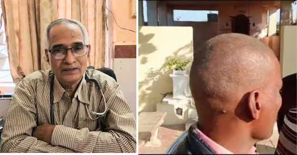 300 Villagers in Maharashtra Lost Their Hair Overnight: A Padma Shri Doctor Found Out Why