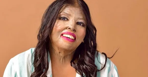 Once Mocked for Her Burn Scars, This Beauty Creator Now Inspires Thousands With Art & Social Media