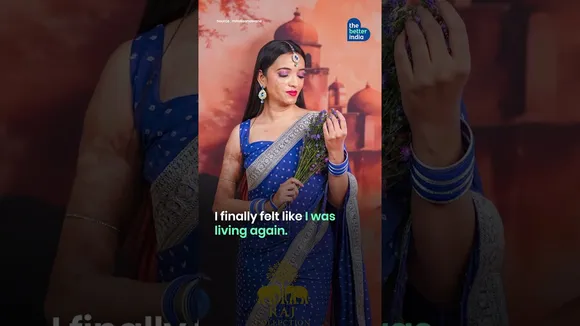 From Burn Victim to Supermodel