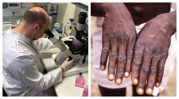 Monkeypox cases detected in over 12 countries