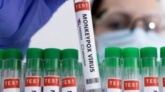 Monkeypox Virus RT PCR-based kit