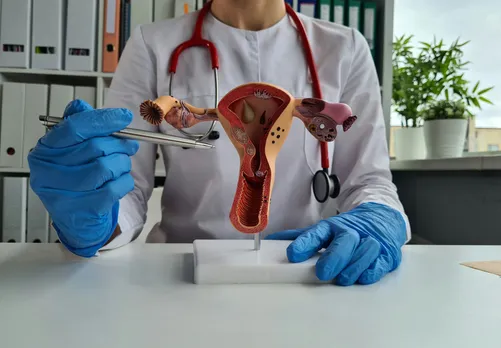 A visual diagram representing the uterus and women's reproductive health