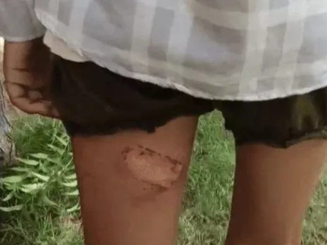 rajasthan-barmer-hostel-abuse-case-august-2025