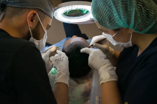 Two dead after hair transplant: Key risks & precautions you need to know