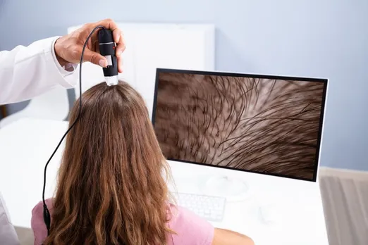 The Role of Dermatologists in Professional Hair Loss Treatment Plans