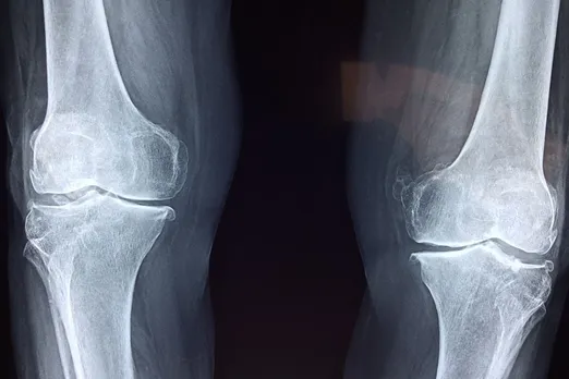 Bone Health 