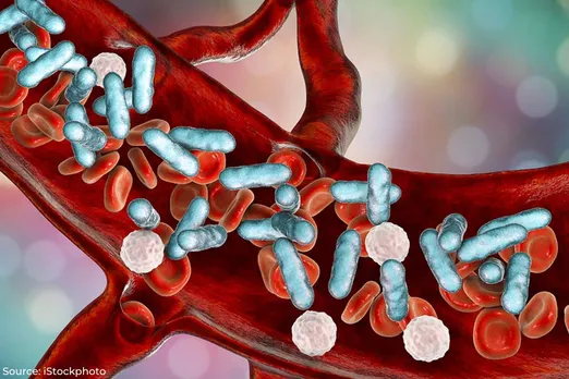 Sepsis: Causes, Symptoms, and treatment Options
