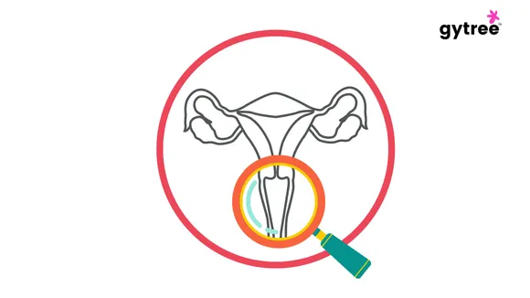 What is a hymen actually? Does it define virginity?