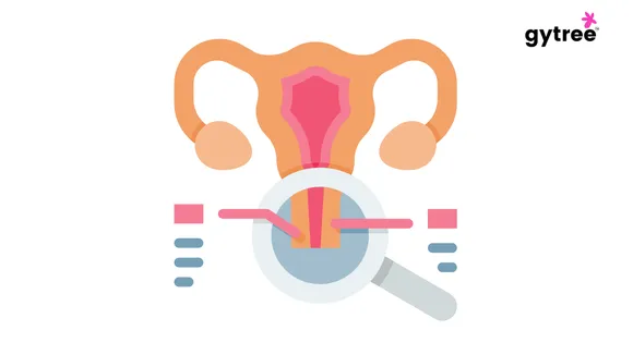 How can you prevent cervical cancer?