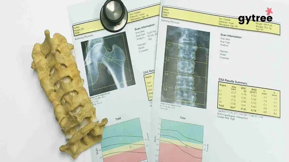 How to prevent osteoporosis