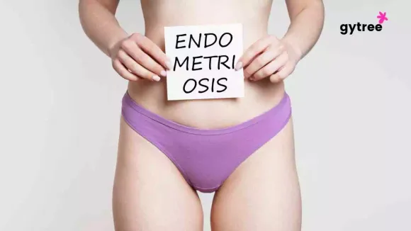Methods of Endometriosis Treatment 