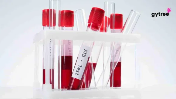 STD Testing Window: Meaning and Importance 