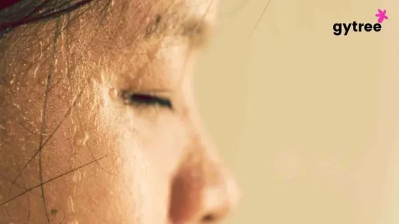 Fanning the flames of Hot Flashes during Menopause