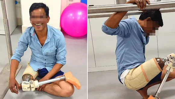 Prosthetic leg