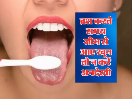Health Tips : ब्रश करते समय जीभ से आए खून तो न करें अनदेखी