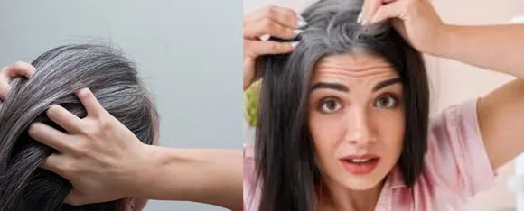 White Hair Black