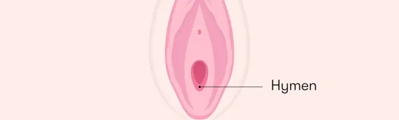 Hymen_0000. png