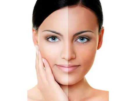 Get Rid Of Sun Tan At Home