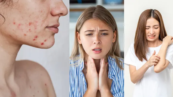 Skin problem 
