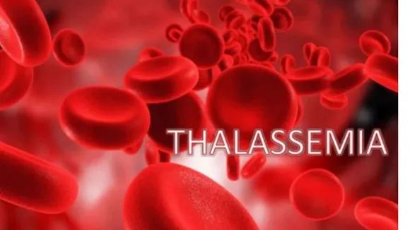 What is Thalassemia and Its Symptoms