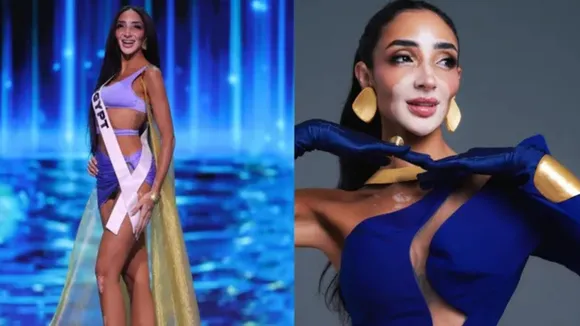 Logina Salah First Contestant With Vitilgo At Miss Universe 2024