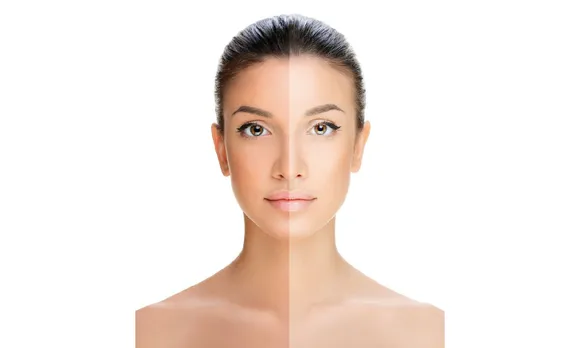 5 Effective Home Remedies To Remove Sun Tan
