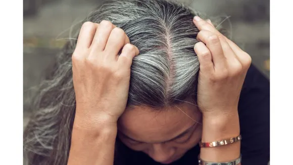Get Rid Of Repeated Coloring Of White Hair By Using This Home Remedy