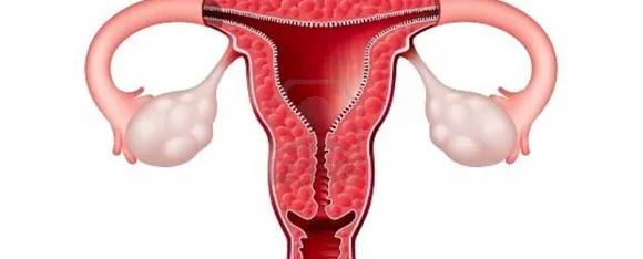 Vaginitis 0.png