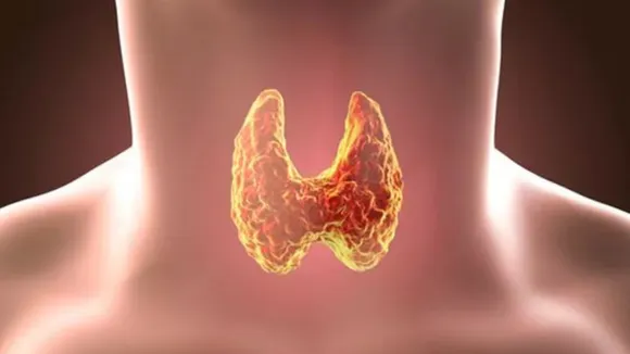 Thyroid (Pinterest).png